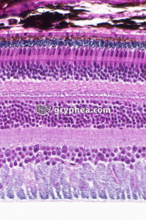 Rétine x100 - gryphea.org